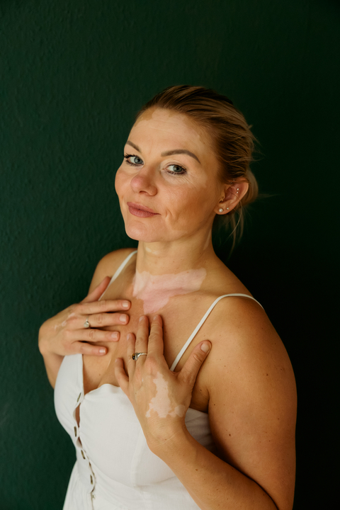 Katie Stu in Summer dress with covering hands